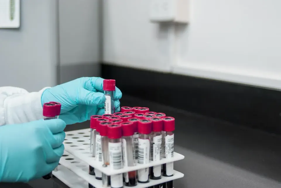lab, experiment, test, chemistry